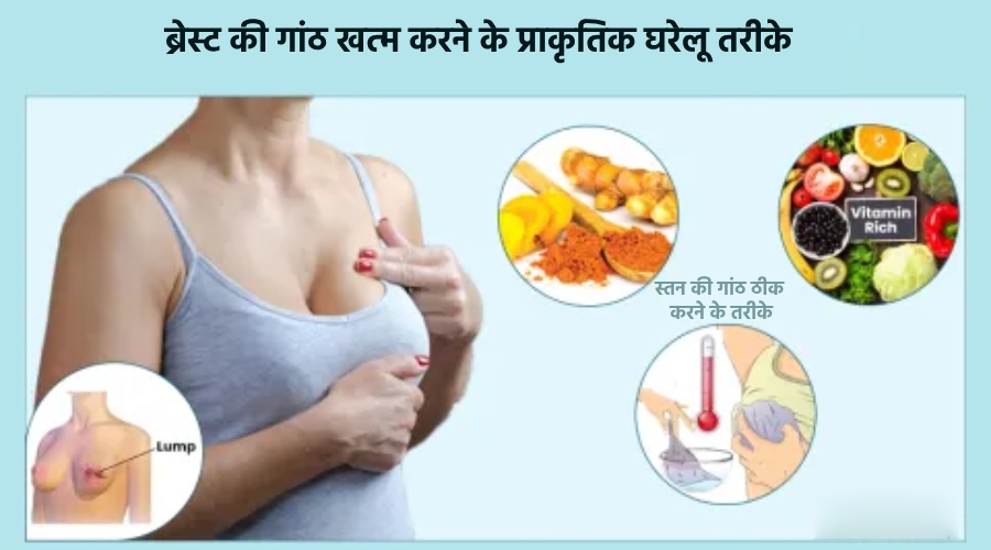 Breast ki Ganth Khatam Karne Ke Gharelu Tareeke