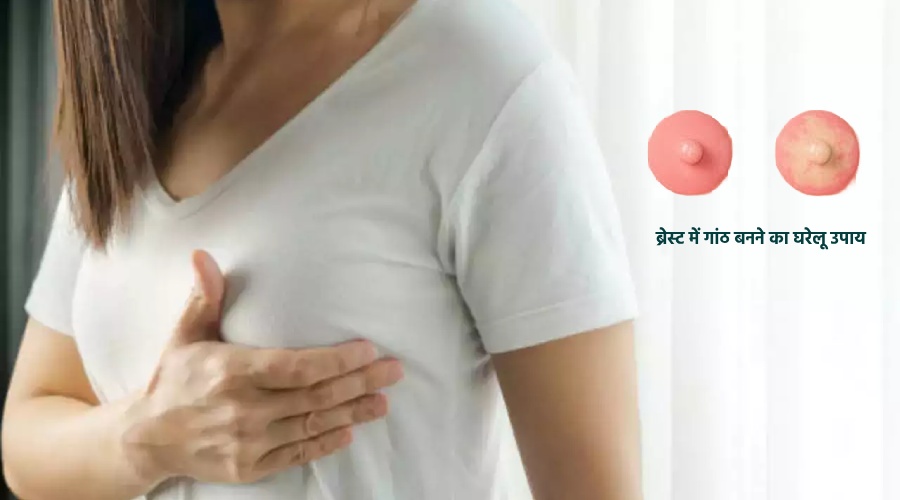 Breast me Gaanth Banane ka Gharelu Upaay