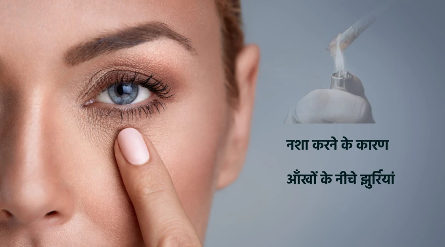 Nashe ke kaaran ankhon ke neeche jhurriyan