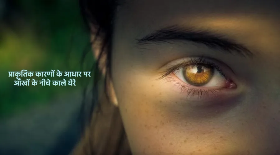 Natural karn ankhon ke neeche dark circle hone ke