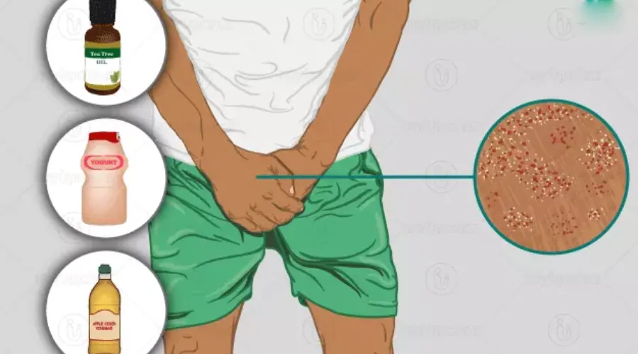 stambhan dosh (penis mein tanav na hona ya ling dhilapan hona) kya hota hain