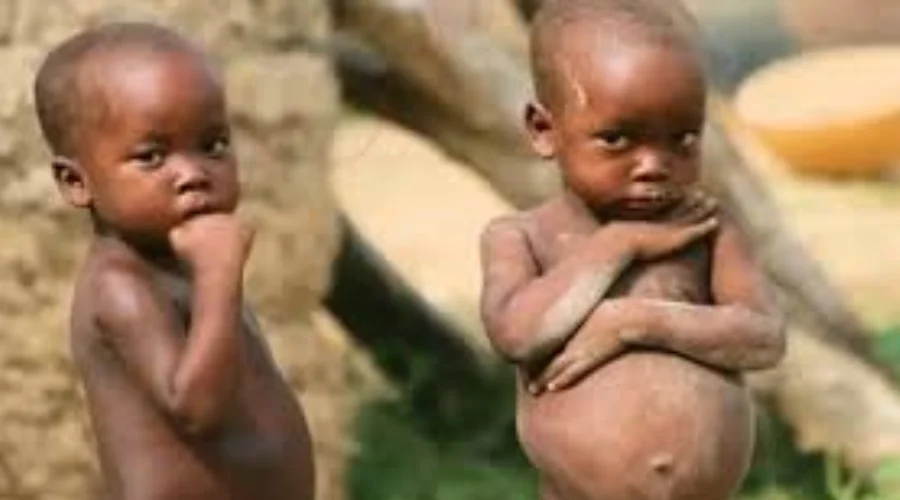 kwashiorkore ke karan