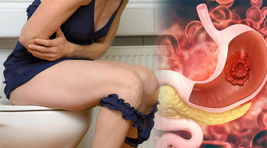 Mal mein khoon aane ka karan